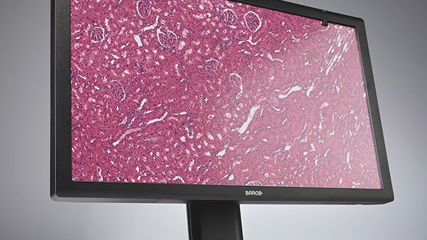 Barco MDPC-8127 Pathology Display Video